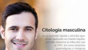 Citología Masculina en Monocapa